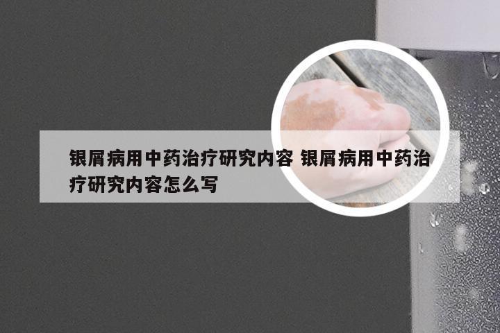银屑病用中药治疗研究内容 银屑病用中药治疗研究内容怎么写