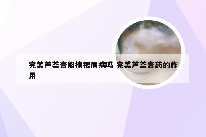完美芦荟膏能擦银屑病吗 完美芦荟膏药的作用