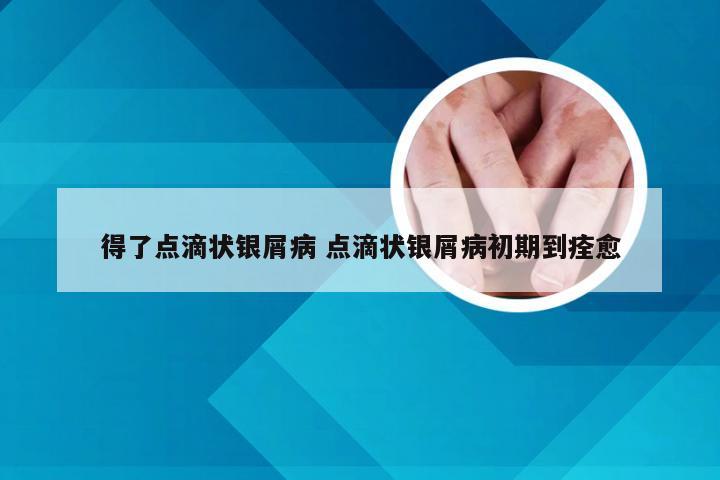 得了点滴状银屑病 点滴状银屑病初期到痊愈