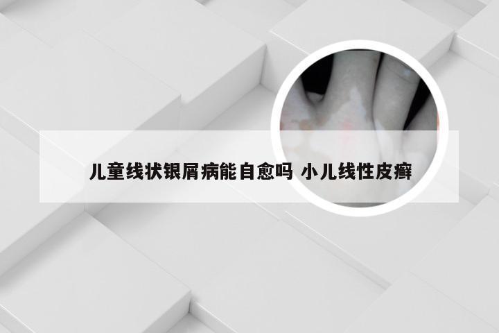 儿童线状银屑病能自愈吗 小儿线性皮癣