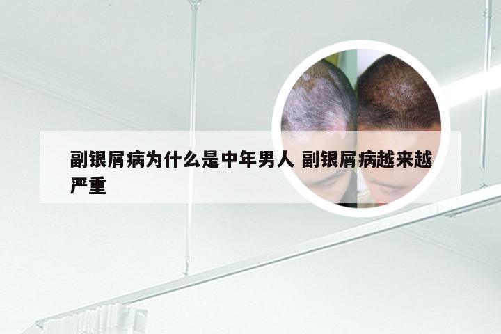 副银屑病为什么是中年男人 副银屑病越来越严重