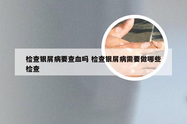 检查银屑病要查血吗 检查银屑病需要做哪些检查