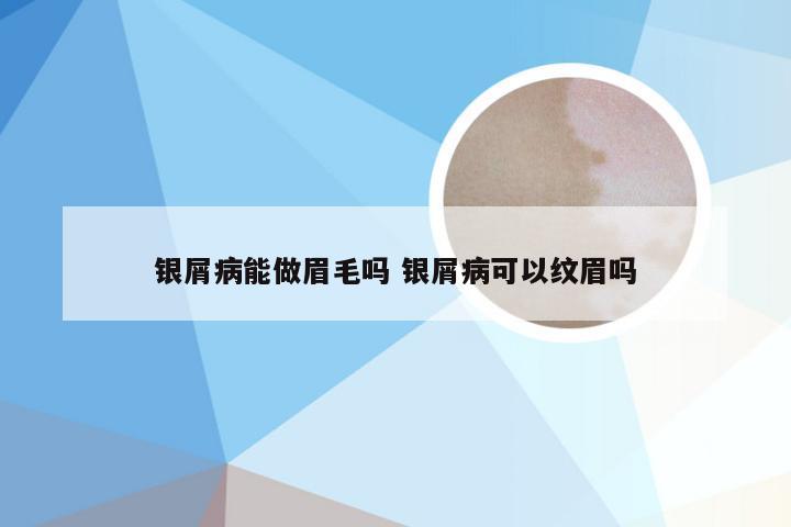 银屑病能做眉毛吗 银屑病可以纹眉吗