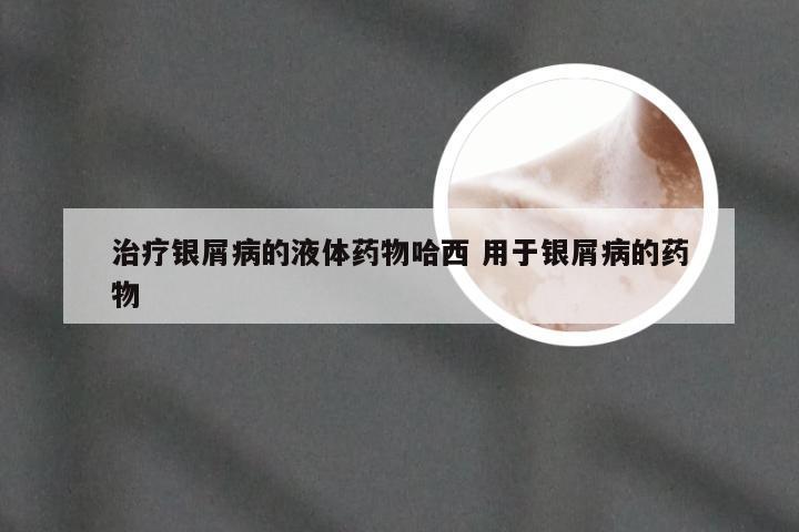 治疗银屑病的液体药物哈西 用于银屑病的药物