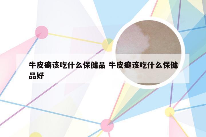 牛皮癣该吃什么保健品 牛皮癣该吃什么保健品好