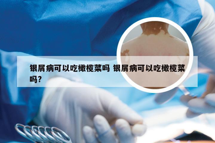 银屑病可以吃橄榄菜吗 银屑病可以吃橄榄菜吗?