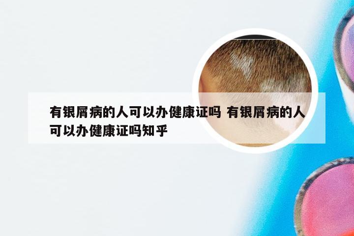 有银屑病的人可以办健康证吗 有银屑病的人可以办健康证吗知乎