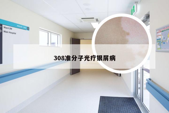 308准分子光疗银屑病