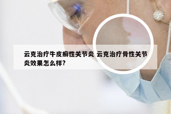 云克治疗牛皮癣性关节炎 云克治疗骨性关节炎效果怎么样?