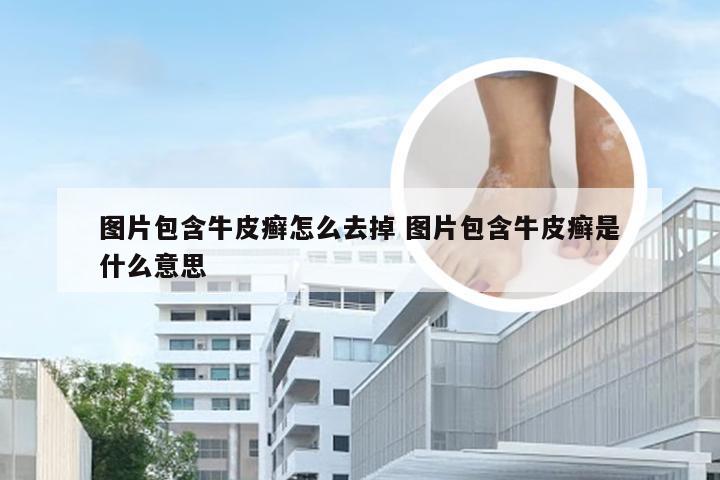 图片包含牛皮癣怎么去掉 图片包含牛皮癣是什么意思