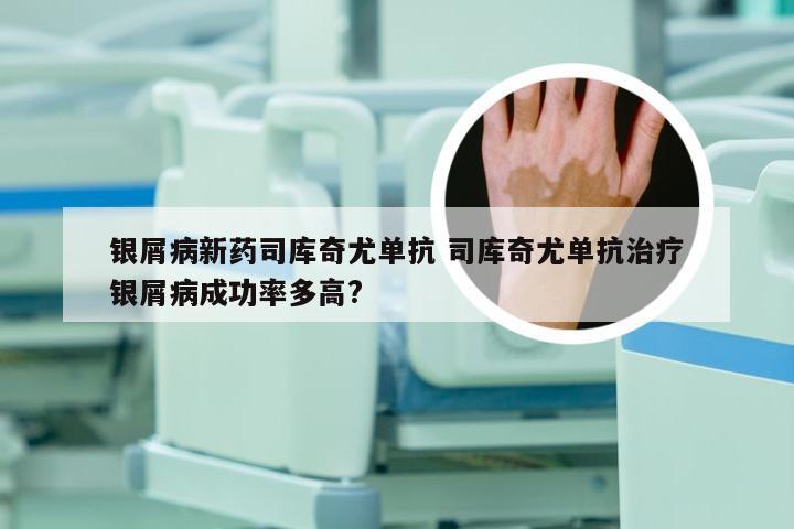 银屑病新药司库奇尤单抗 司库奇尤单抗治疗银屑病成功率多高?