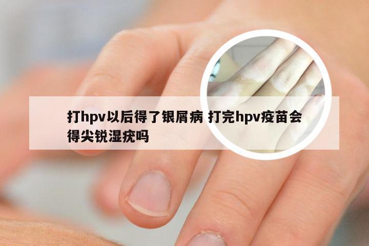 打hpv以后得了银屑病 打完hpv疫苗会得尖锐湿疣吗