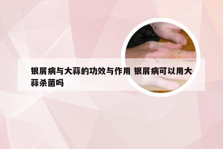 银屑病与大蒜的功效与作用 银屑病可以用大蒜杀菌吗