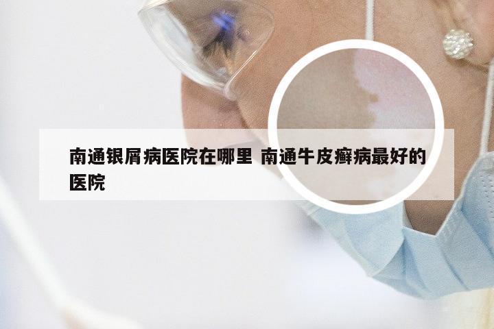 南通银屑病医院在哪里 南通牛皮癣病最好的医院