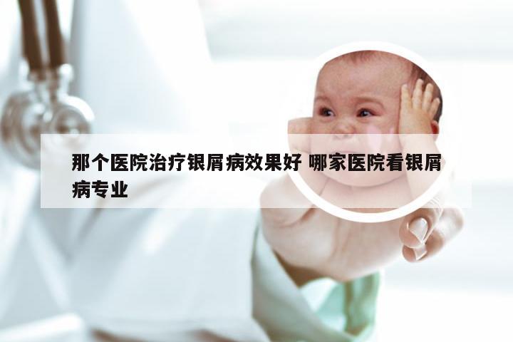 那个医院治疗银屑病效果好 哪家医院看银屑病专业