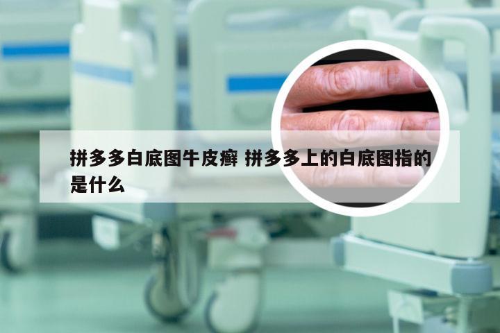 拼多多白底图牛皮癣 拼多多上的白底图指的是什么