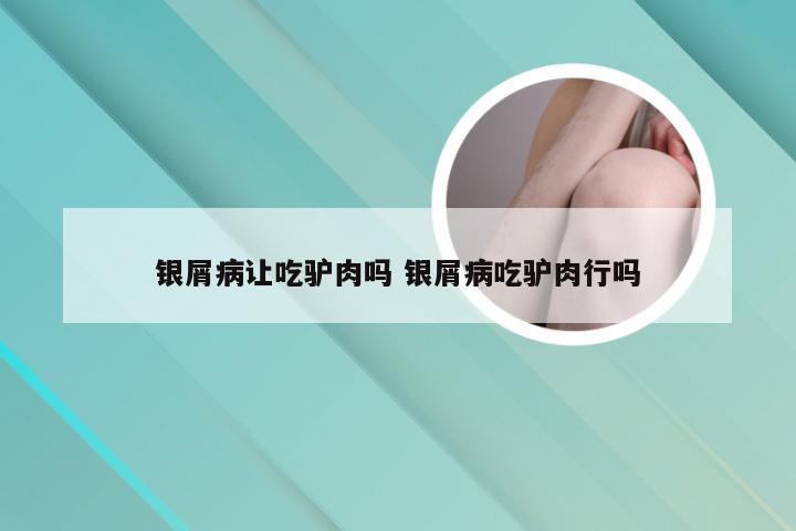 银屑病让吃驴肉吗 银屑病吃驴肉行吗