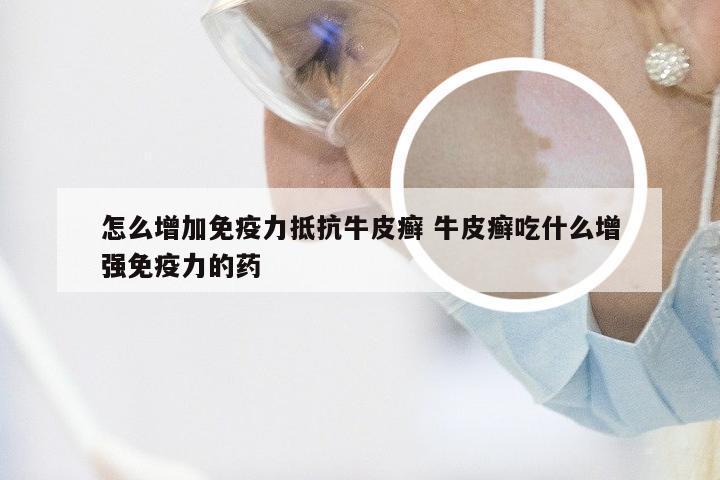 怎么增加免疫力抵抗牛皮癣 牛皮癣吃什么增强免疫力的药