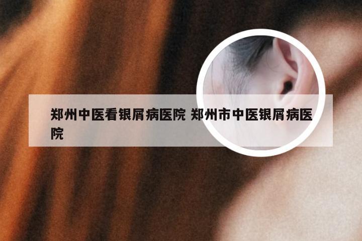 郑州中医看银屑病医院 郑州市中医银屑病医院