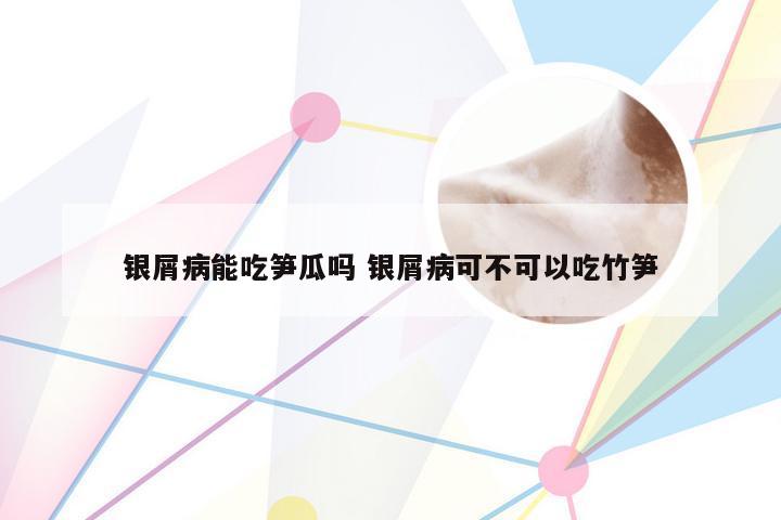 银屑病能吃笋瓜吗 银屑病可不可以吃竹笋