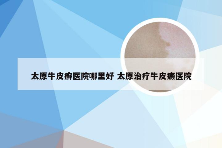 太原牛皮癣医院哪里好 太原治疗牛皮癜医院