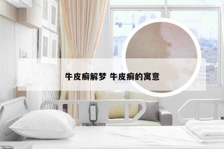 牛皮癣解梦 牛皮癣的寓意
