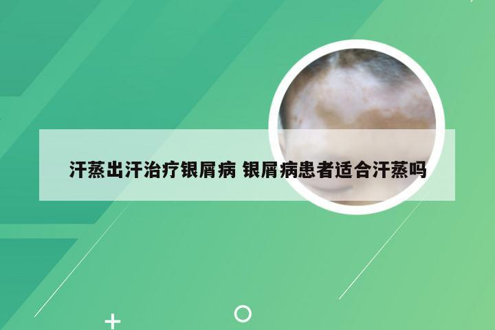 汗蒸出汗治疗银屑病 银屑病患者适合汗蒸吗