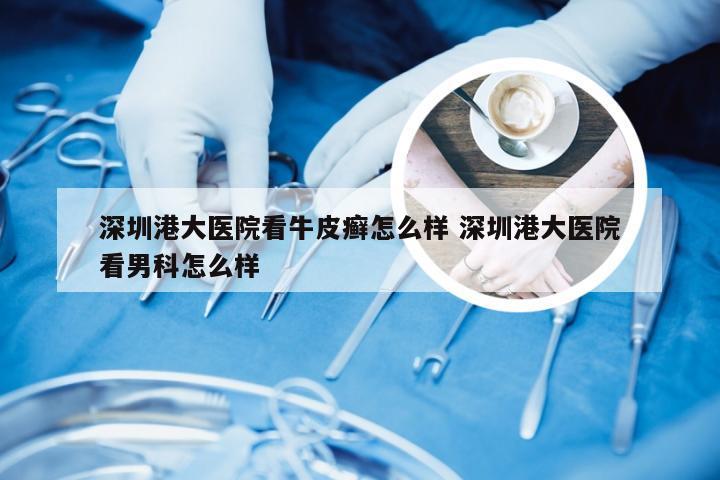 深圳港大医院看牛皮癣怎么样 深圳港大医院看男科怎么样
