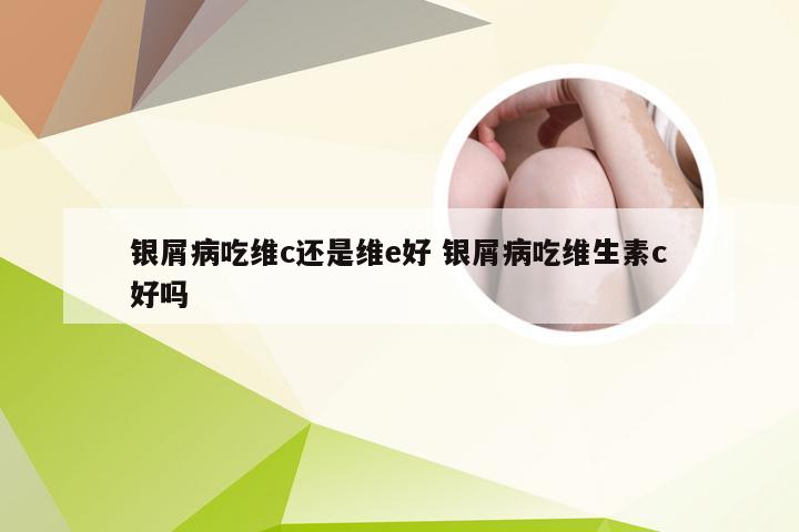 银屑病吃维c还是维e好 银屑病吃维生素c好吗