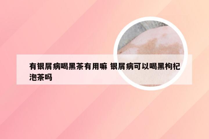 有银屑病喝黑茶有用嘛 银屑病可以喝黑枸杞泡茶吗