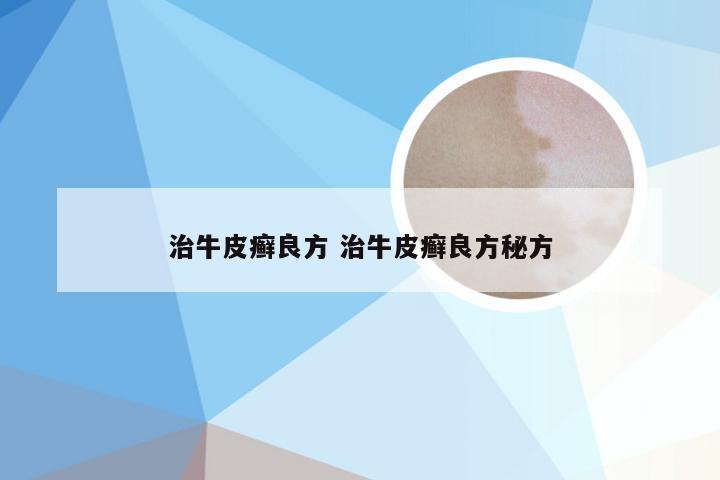 治牛皮癣良方 治牛皮癣良方秘方