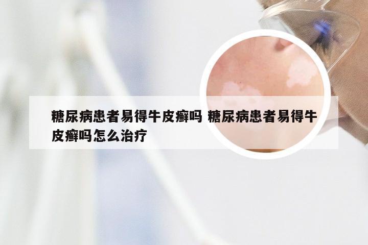 糖尿病患者易得牛皮癣吗 糖尿病患者易得牛皮癣吗怎么治疗