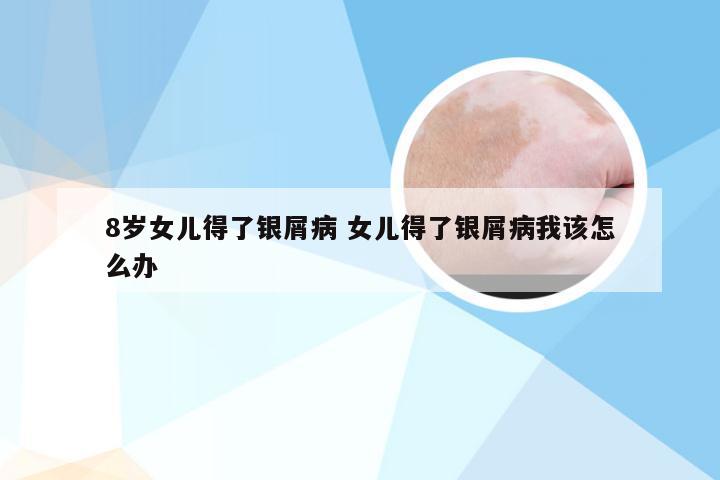 8岁女儿得了银屑病 女儿得了银屑病我该怎么办