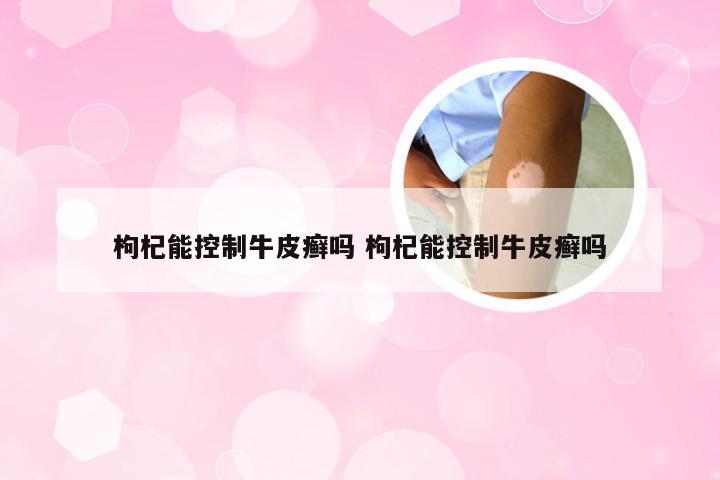 枸杞能控制牛皮癣吗 枸杞能控制牛皮癣吗