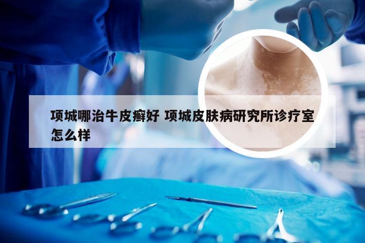 项城哪治牛皮癣好 项城皮肤病研究所诊疗室怎么样