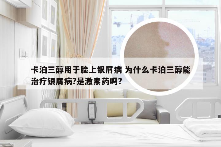 卡泊三醇用于脸上银屑病 为什么卡泊三醇能治疗银屑病?是激素药吗?