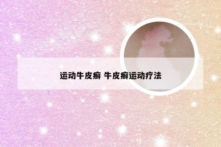 运动牛皮癣 牛皮癣运动疗法