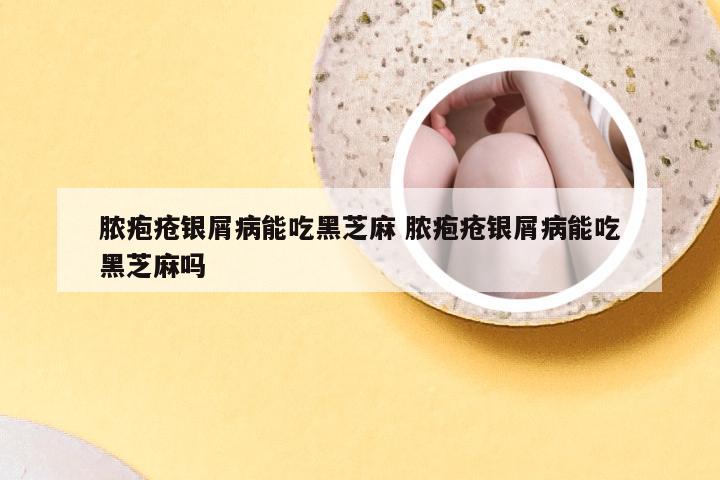 脓疱疮银屑病能吃黑芝麻 脓疱疮银屑病能吃黑芝麻吗