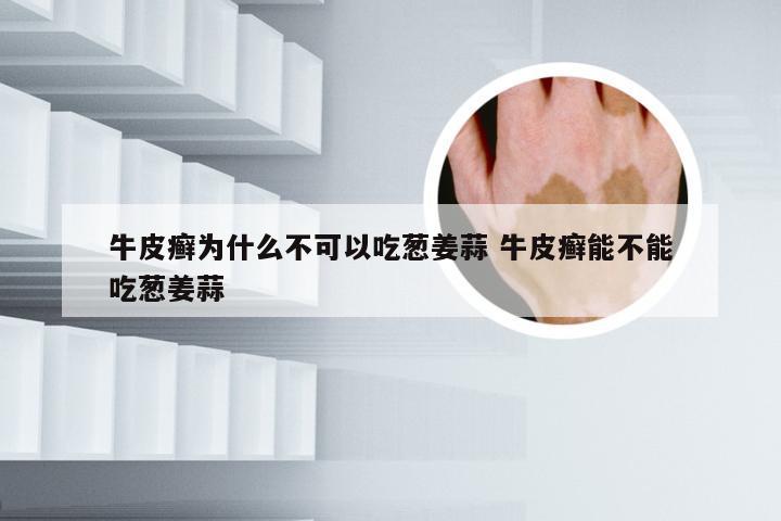 牛皮癣为什么不可以吃葱姜蒜 牛皮癣能不能吃葱姜蒜