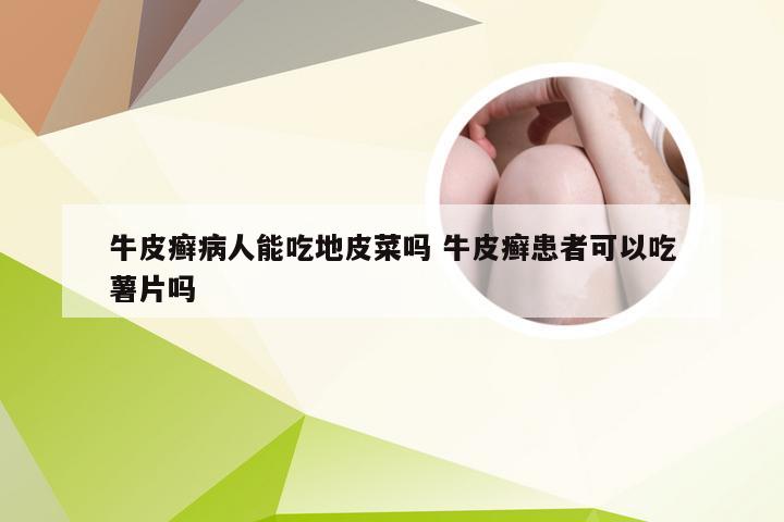 牛皮癣病人能吃地皮菜吗 牛皮癣患者可以吃薯片吗