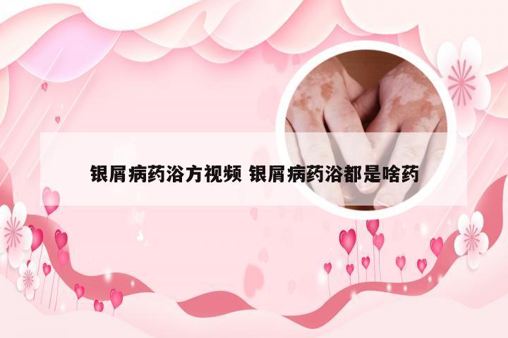 银屑病药浴方视频 银屑病药浴都是啥药