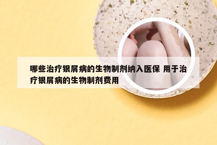 哪些治疗银屑病的生物制剂纳入医保 用于治疗银屑病的生物制剂费用