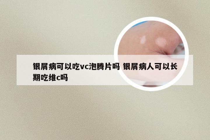银屑病可以吃vc泡腾片吗 银屑病人可以长期吃维c吗