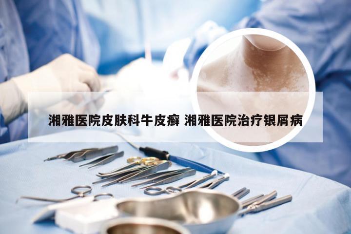 湘雅医院皮肤科牛皮癣 湘雅医院治疗银屑病