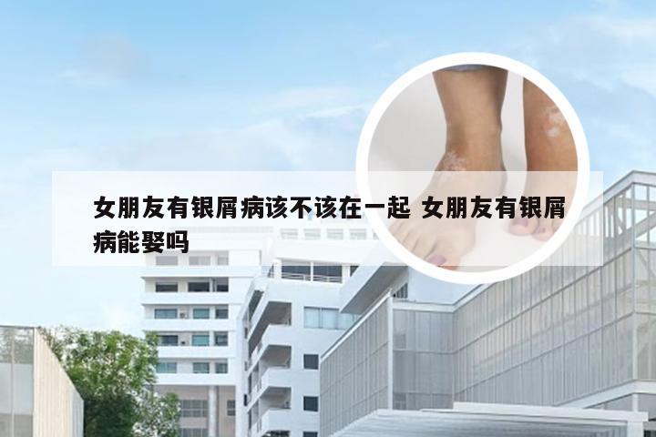 女朋友有银屑病该不该在一起 女朋友有银屑病能娶吗