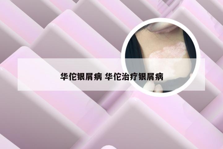 华佗银屑病 华佗治疗银屑病