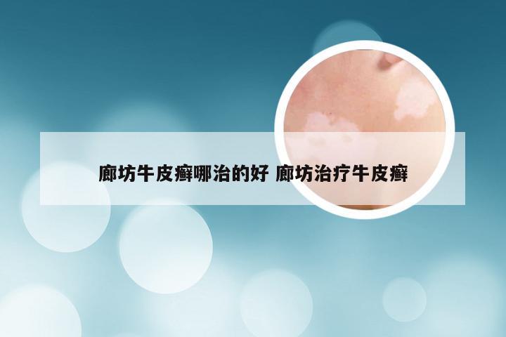 廊坊牛皮癣哪治的好 廊坊治疗牛皮癣