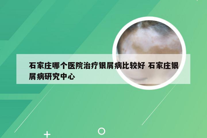 石家庄哪个医院治疗银屑病比较好 石家庄银屑病研究中心