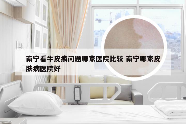 南宁看牛皮癣问题哪家医院比较 南宁哪家皮肤病医院好