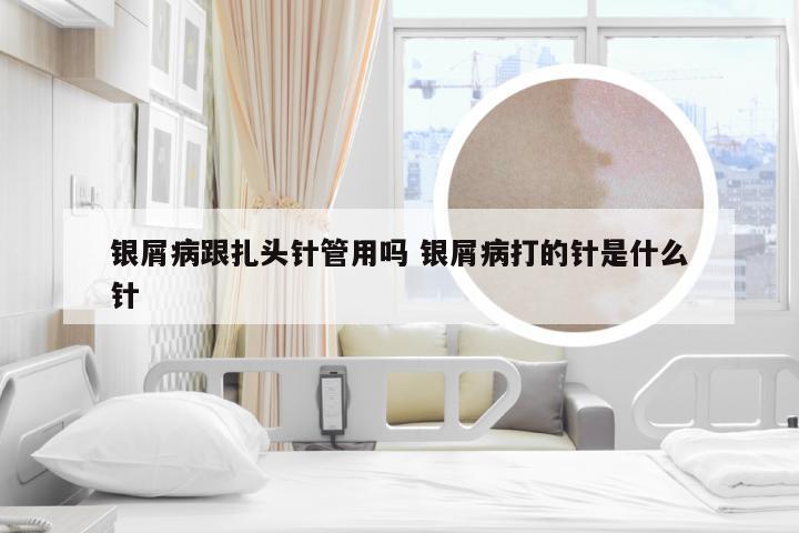 银屑病跟扎头针管用吗 银屑病打的针是什么针